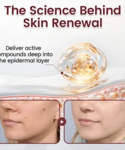 Natravor® BumpAway Gentle Renewal Cream