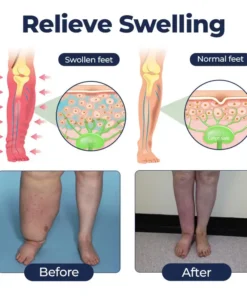 Natravor® SwellRelief Circulation Support Cream