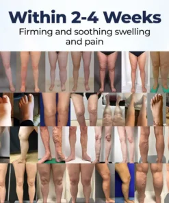 Natravor® SwellRelief Circulation Support Cream