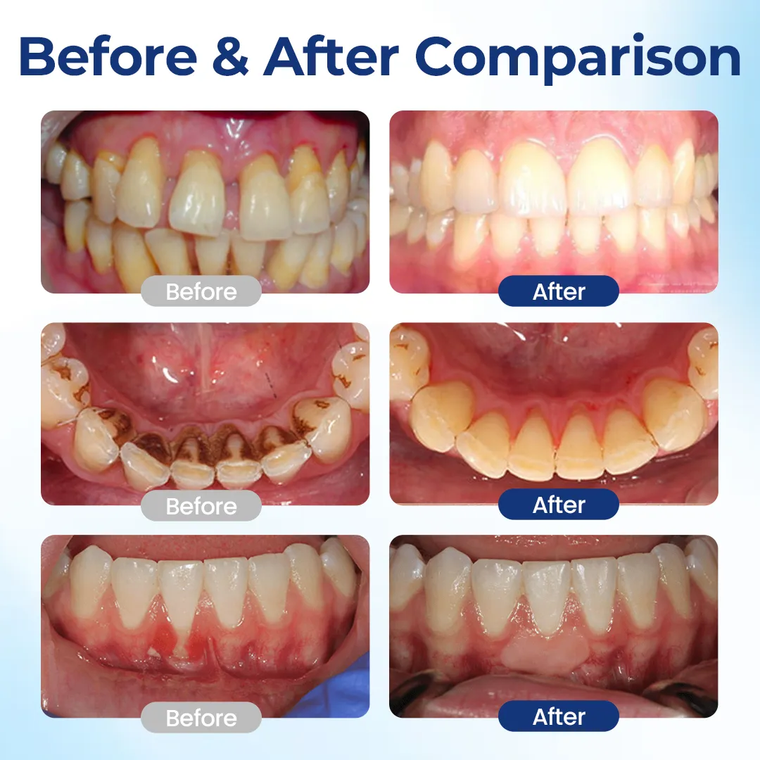 NATRAVOR® BeeTakt Oral Repair Solution - Image 3