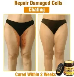 Natravor®𝐁𝐞𝐞 𝐕𝐞𝐧𝐨𝐦 𝐀𝐥𝐥-𝐢𝐧-𝐎𝐧𝐞 𝐂𝐫𝐞𝐚𝐦