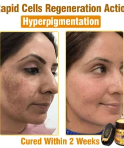 Natravor®𝐁𝐞𝐞 𝐕𝐞𝐧𝐨𝐦 𝐀𝐥𝐥-𝐢𝐧-𝐎𝐧𝐞 𝐂𝐫𝐞𝐚𝐦