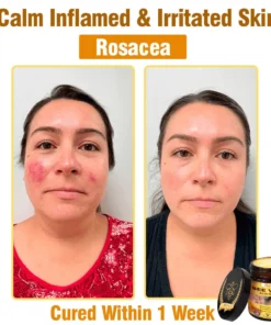 Natravor®𝐁𝐞𝐞 𝐕𝐞𝐧𝐨𝐦 𝐀𝐥𝐥-𝐢𝐧-𝐎𝐧𝐞 𝐂𝐫𝐞𝐚𝐦