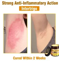 Natravor®𝐁𝐞𝐞 𝐕𝐞𝐧𝐨𝐦 𝐀𝐥𝐥-𝐢𝐧-𝐎𝐧𝐞 𝐂𝐫𝐞𝐚𝐦