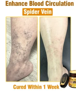 Natravor®𝐁𝐞𝐞 𝐕𝐞𝐧𝐨𝐦 𝐀𝐥𝐥-𝐢𝐧-𝐎𝐧𝐞 𝐂𝐫𝐞𝐚𝐦