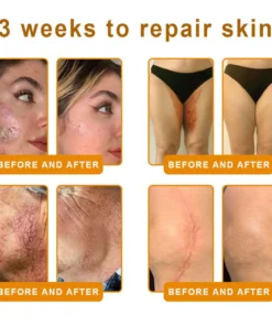 Natravor®𝐁𝐞𝐞 𝐕𝐞𝐧𝐨𝐦 𝐀𝐥𝐥-𝐢𝐧-𝐎𝐧𝐞 𝐂𝐫𝐞𝐚𝐦