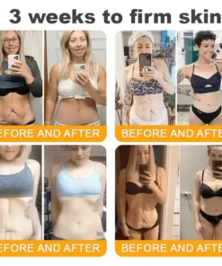 Natravor®𝐁𝐞𝐞 𝐕𝐞𝐧𝐨𝐦 𝐀𝐥𝐥-𝐢𝐧-𝐎𝐧𝐞 𝐂𝐫𝐞𝐚𝐦