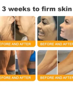 Natravor®𝐁𝐞𝐞 𝐕𝐞𝐧𝐨𝐦 𝐀𝐥𝐥-𝐢𝐧-𝐎𝐧𝐞 𝐂𝐫𝐞𝐚𝐦