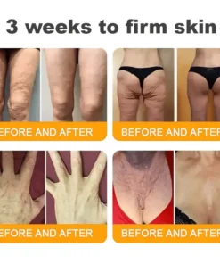 Natravor®𝐁𝐞𝐞 𝐕𝐞𝐧𝐨𝐦 𝐀𝐥𝐥-𝐢𝐧-𝐎𝐧𝐞 𝐂𝐫𝐞𝐚𝐦