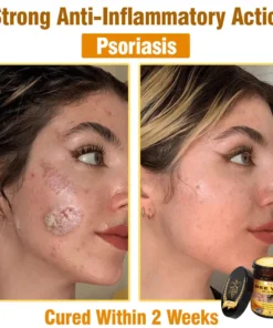 Natravor®𝐁𝐞𝐞 𝐕𝐞𝐧𝐨𝐦 𝐀𝐥𝐥-𝐢𝐧-𝐎𝐧𝐞 𝐂𝐫𝐞𝐚𝐦