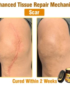 Natravor®𝐁𝐞𝐞 𝐕𝐞𝐧𝐨𝐦 𝐀𝐥𝐥-𝐢𝐧-𝐎𝐧𝐞 𝐂𝐫𝐞𝐚𝐦