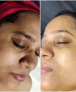 Natravor® Melanin Correcting Facial Serum