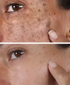 Natravor® Melanin Correcting Facial Serum