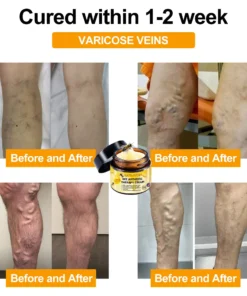 NATRAVOR® AdvancedJoint and BoneTherapy Cream