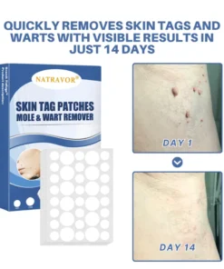 NATRAVOR® Moles & Warts Removing Skin Tag Patch