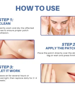 NATRAVOR® Moles & Warts Removing Skin Tag Patch