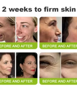 NATRAVOR® Skin Tightening & Vita-A Retinol Retinol shot Anti-Wrinkle Firming Tightening cream