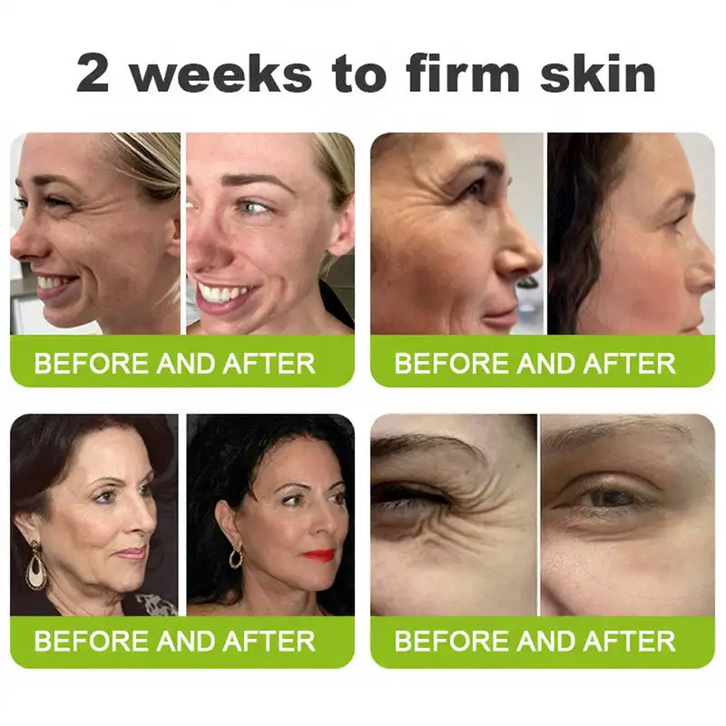 NATRAVOR® Skin Tightening & Vita-A Retinol Retinol shot Anti-Wrinkle Firming Tightening cream