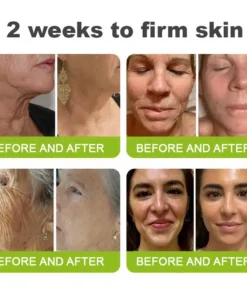 NATRAVOR® Skin Tightening & Vita-A Retinol Retinol shot Anti-Wrinkle Firming Tightening cream