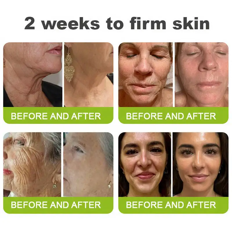NATRAVOR® Skin Tightening & Vita-A Retinol Retinol shot Anti-Wrinkle Firming Tightening cream