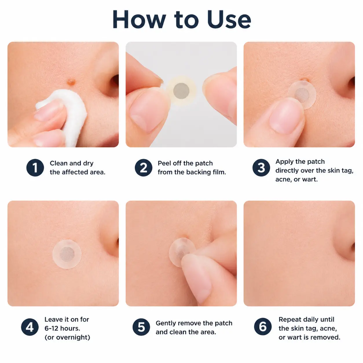 Natrvor® 2-in-1 Microneedle & Hydrocolloid Patch
