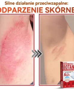 Natrvor® Patches for removing warts and moles using plant-based micro-needles