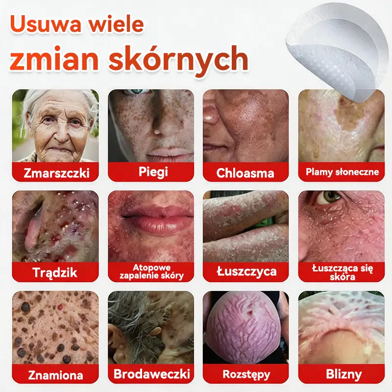 Natrvor® Patches for removing warts and moles using plant-based micro-needles