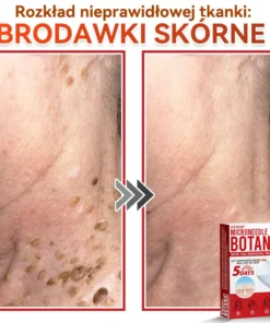 Natrvor® Patches for removing warts and moles using plant-based micro-needles