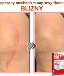 Natrvor® Patches for removing warts and moles using plant-based micro-needles