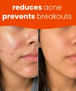 NATRAVOR® Turmeric Kojic Glow Pads