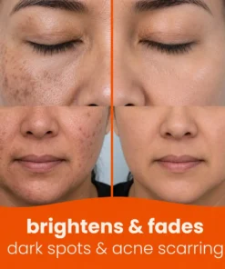 NATRAVOR® Turmeric Kojic Glow Pads