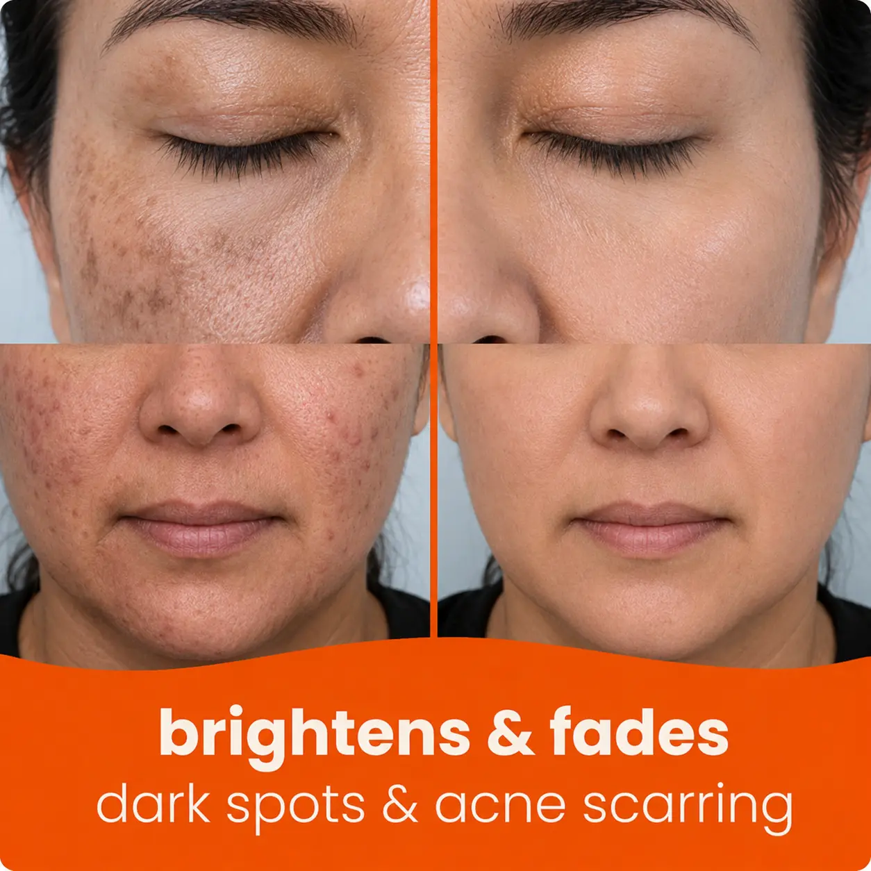 NATRAVOR® Turmeric Kojic Glow Pads