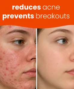 NATRAVOR® Turmeric Kojic Glow Pads