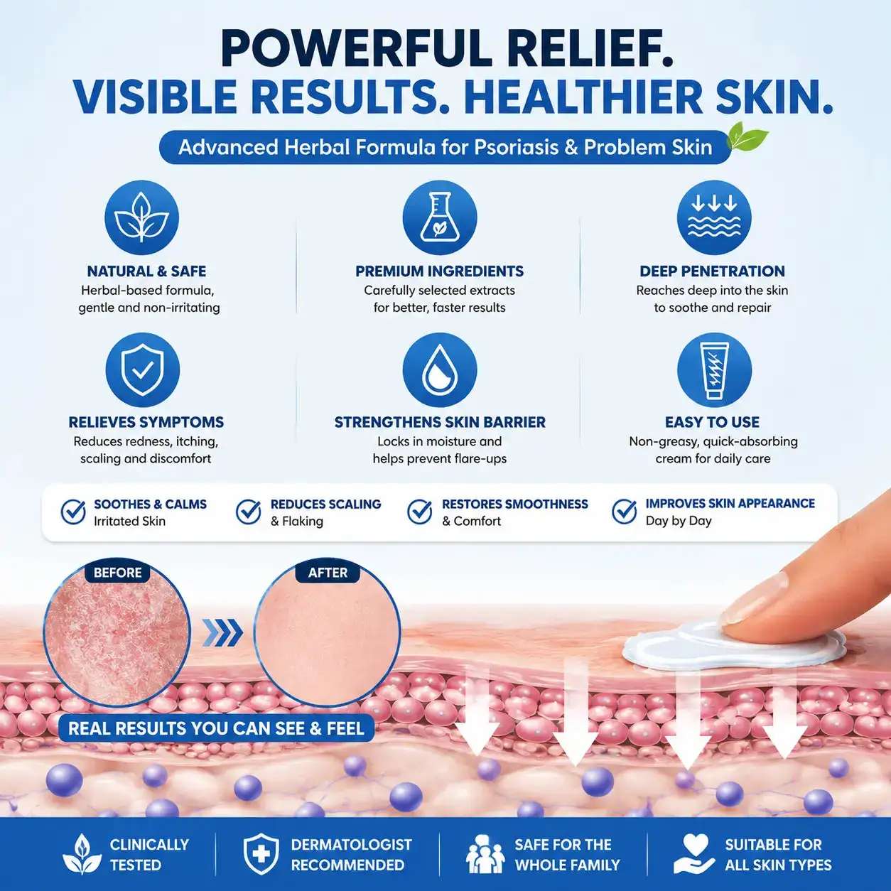 NATRAVOR® Botanical Skin Relief Ointment