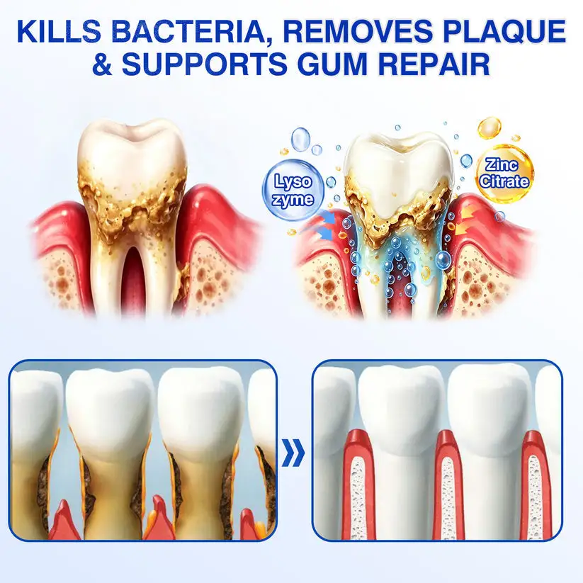 NATRAVOR® GumCare Pro