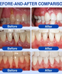 NATRAVOR® GumRevive Periodontal Repair Gel