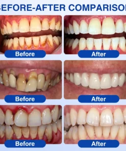 NATRAVOR® GumRevive Periodontal Repair Gel