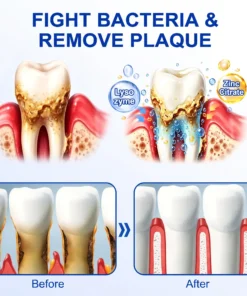 NATRAVOR® GumRevive Periodontal Repair Gel