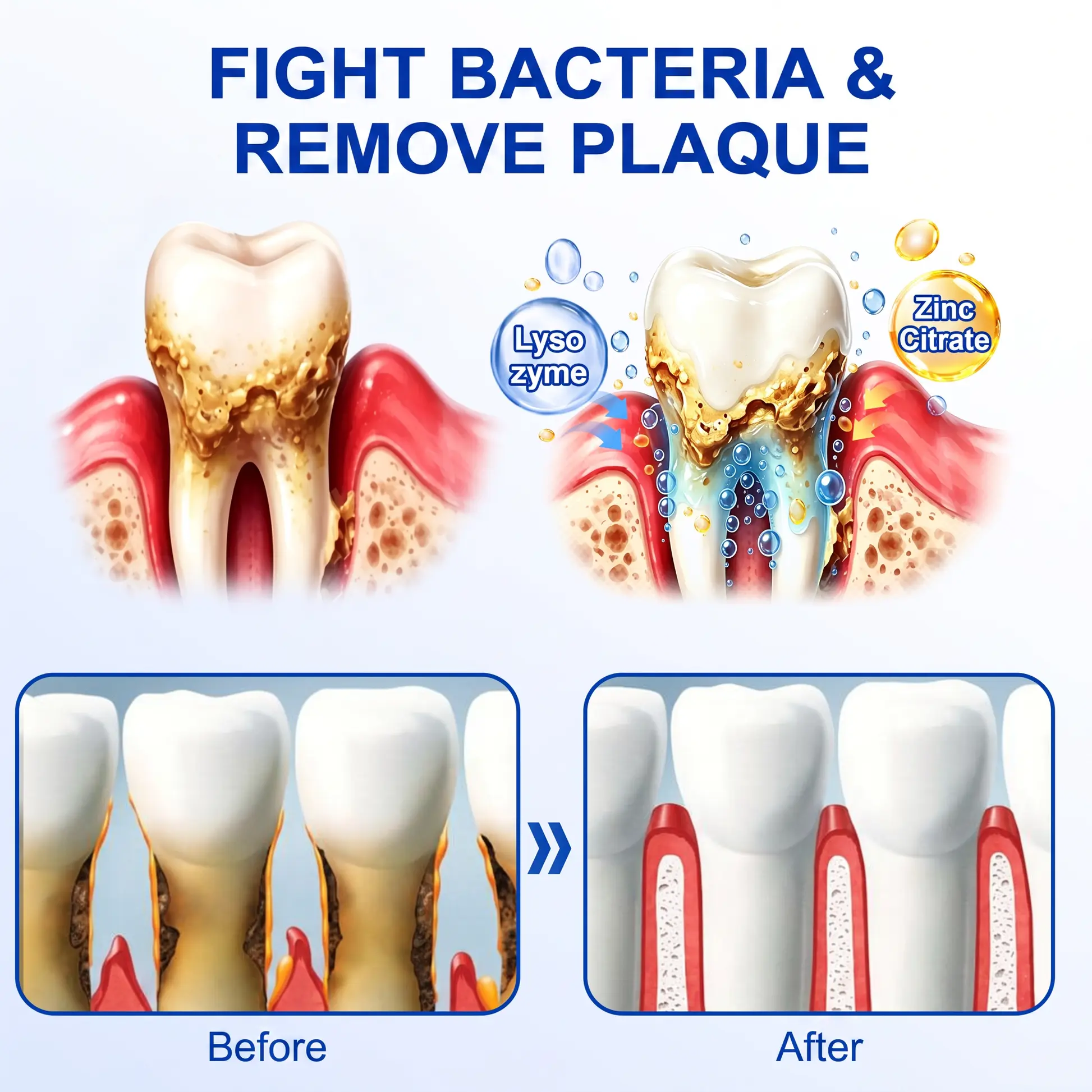 NATRAVOR® GumRevive Periodontal Repair Gel