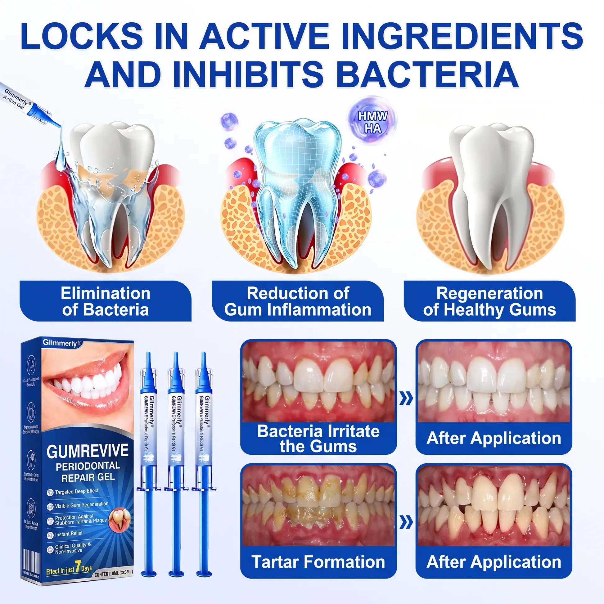 NATRAVOR® GumRevive Periodontal Repair Gel