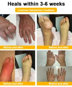 NATRAVOR® Maximum-Strength Joint Relief Cream