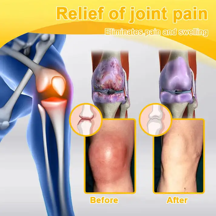 NATRAVOR® Maximum-Strength Joint Relief Cream