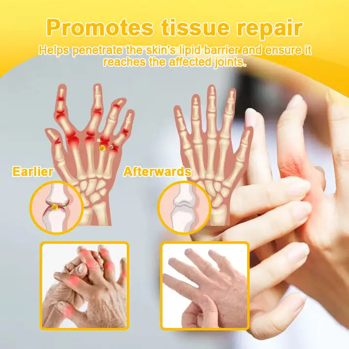 NATRAVOR® Maximum-Strength Joint Relief Cream