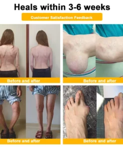 NATRAVOR® Maximum-Strength Joint Relief Cream