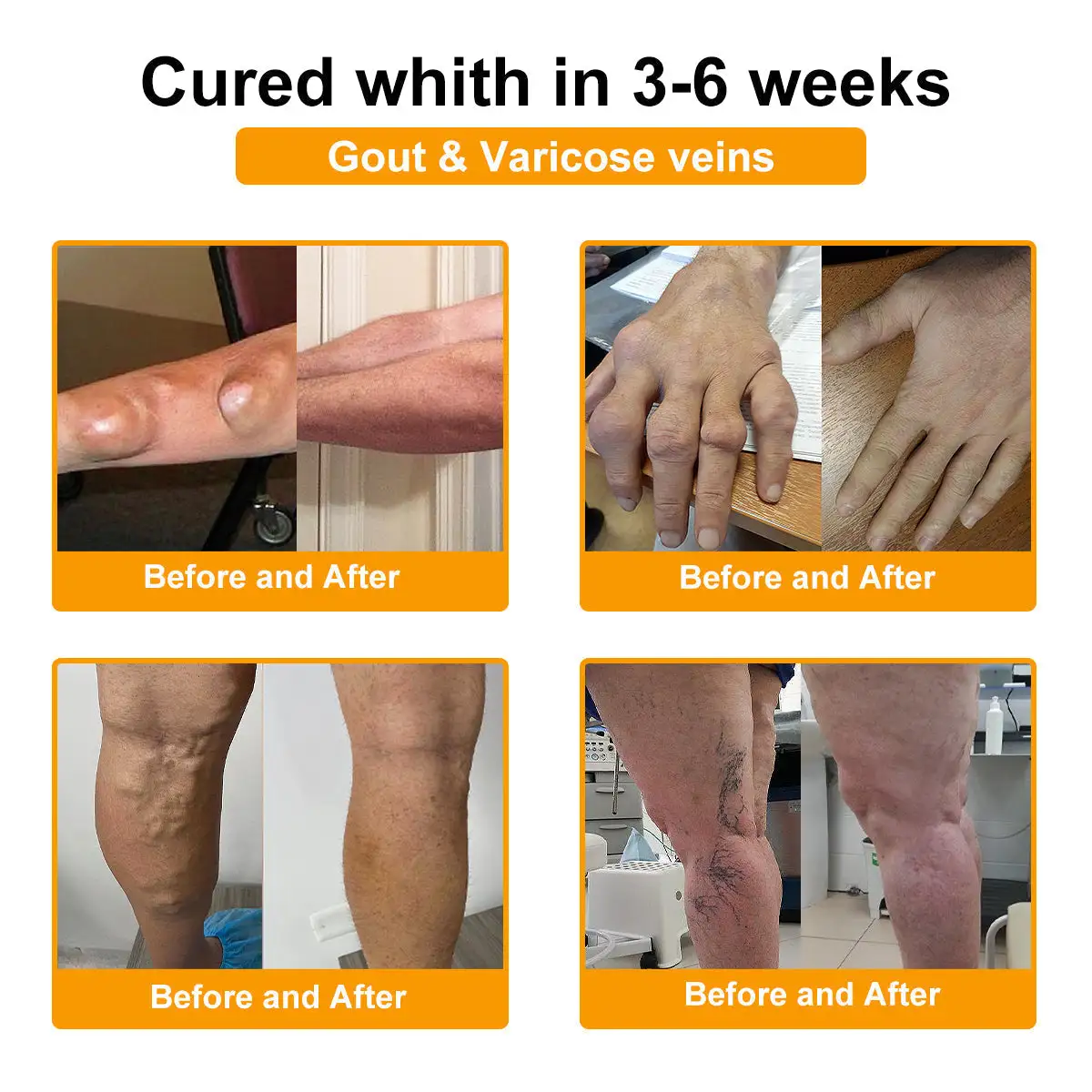 NATRAVOR® Maximum-Strength Joint Relief Cream