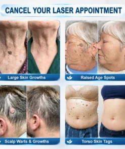 Natravor® 7-Day Cream for Skin Tags & Spots