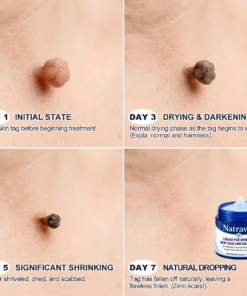 Natravor® 7-Day Cream for Skin Tags & Spots