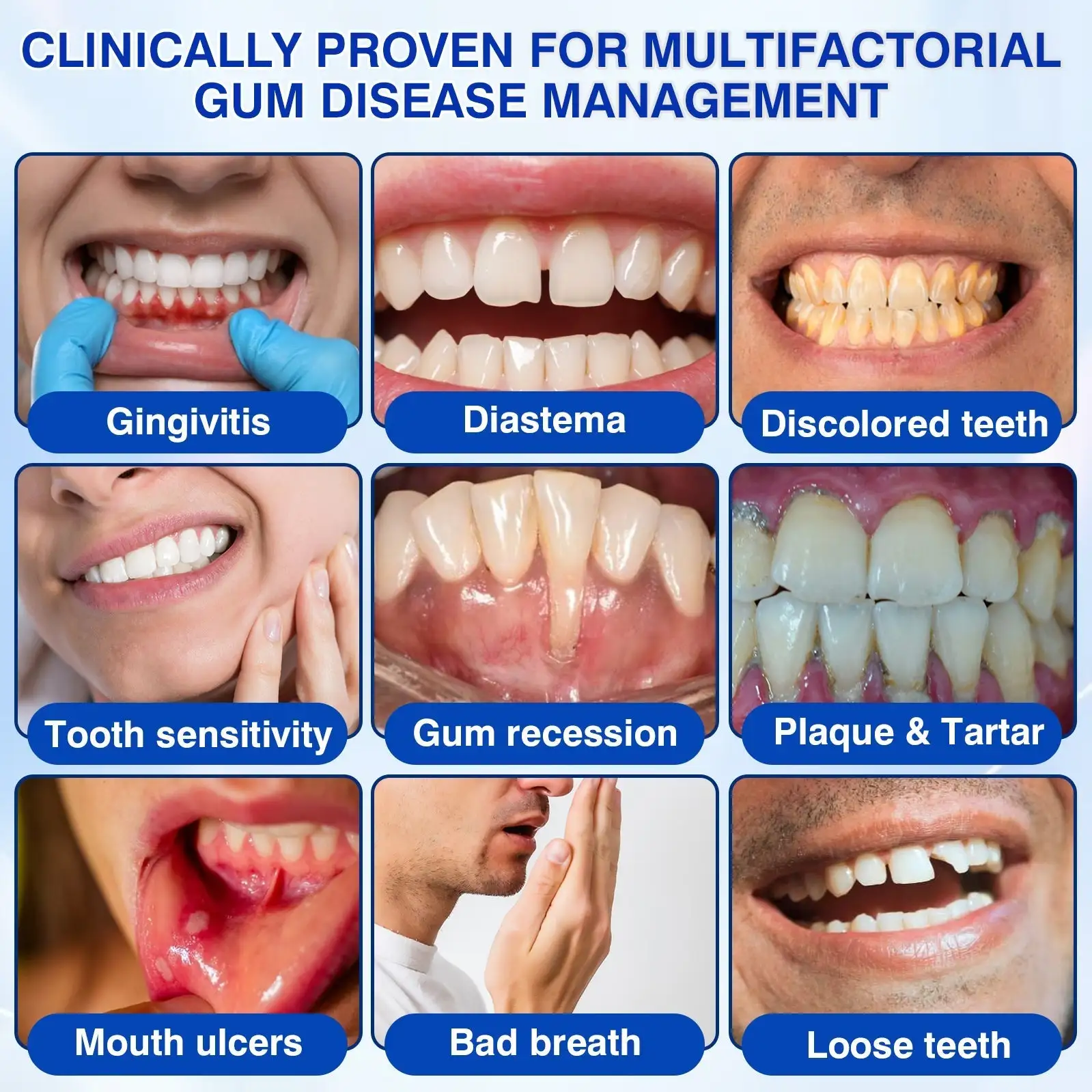 Natravor® Thismile NH-10 Toothpaste Serum for Enamel & Gum – Advanced Therapy