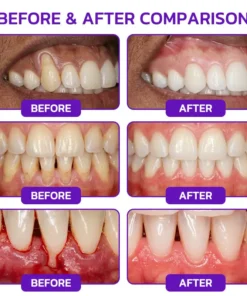 𝐍𝐚𝐭𝐫𝐚𝐯𝐨𝐫® VioCore Bee Venom Gingivitis & Periodontitis Treatment Toothpaste