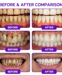 𝐍𝐚𝐭𝐫𝐚𝐯𝐨𝐫® VioCore Bee Venom Gingivitis & Periodontitis Treatment Toothpaste